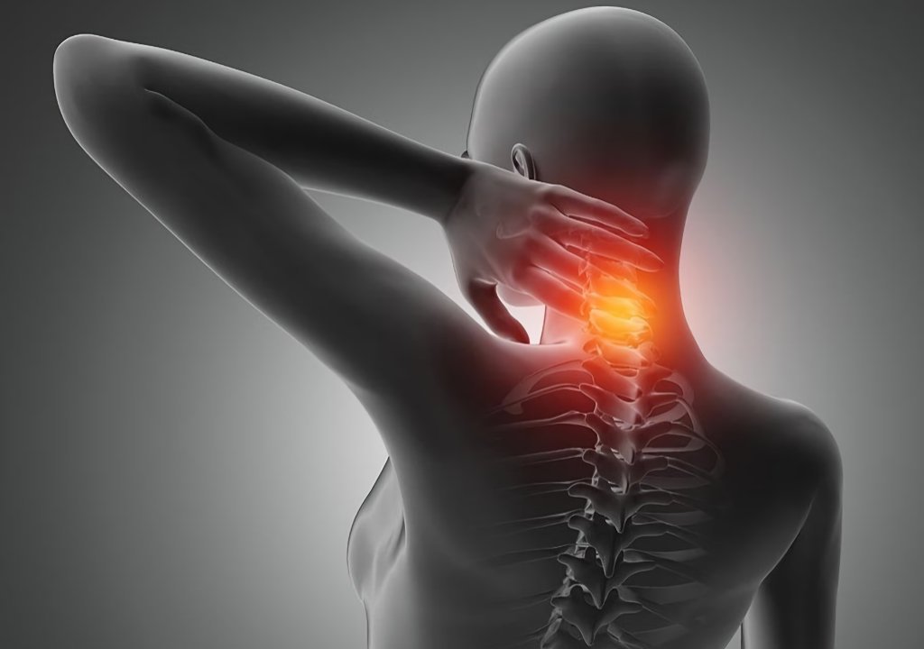 Cervical-Spondylosis-Pain-Conditions Cervical Spondylosis Pain Conditions in Gilbert AZ