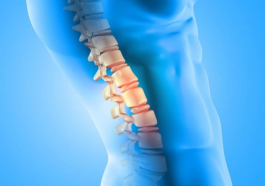 Degenerative-Disc-Pain-Treatment-In-Gilbert Degenerative Disc Pain Treatment In Gilbert